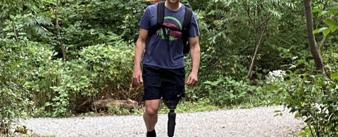 Amputee Dave Cummings